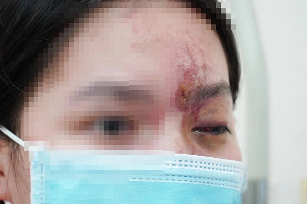 Chị em cần thận trọng trước bẫy “đẹp nhanh, đẹp rẻ”