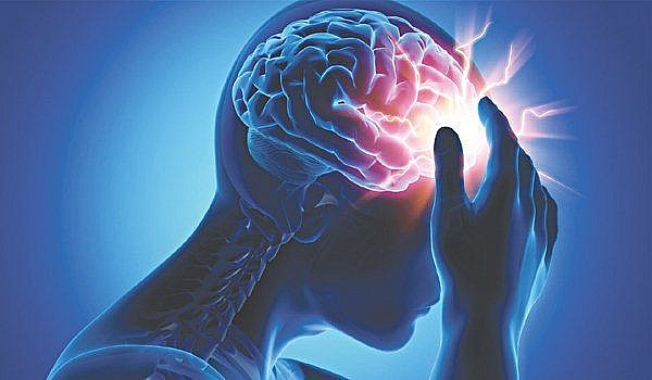 Những dấu hiệu cảnh báo sớm đột quỵ: Nhận biết kịp thời để cứu sống người bệnh