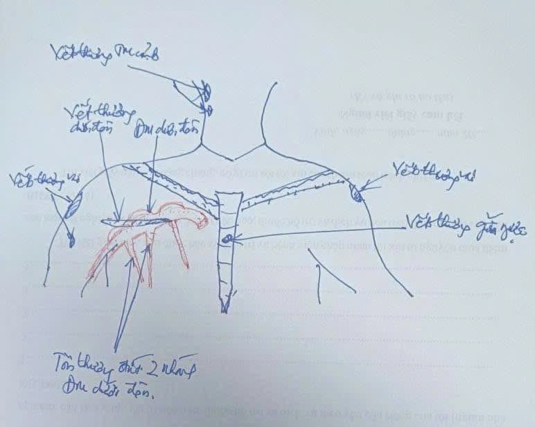 Từ vụ hành hung nhân viên y tế ở Nghệ An:  Cần luật hóa mạnh mẽ hơn để bảo vệ người thầy thuốc
