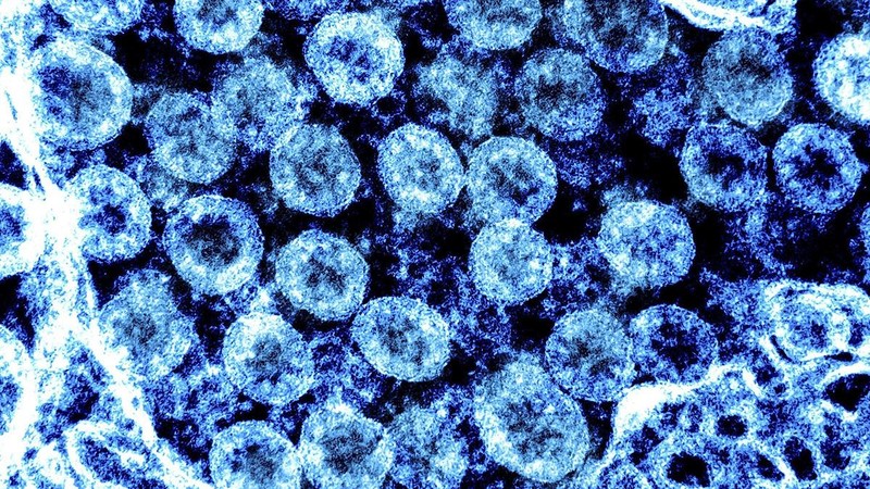 Hình ảnh từ kính hiển vi virus SARS-CoV-2 trong mẫu bệnh phẩm của bệnh nhân mắc Covid-19. (Ảnh: AFP/TTXVN)